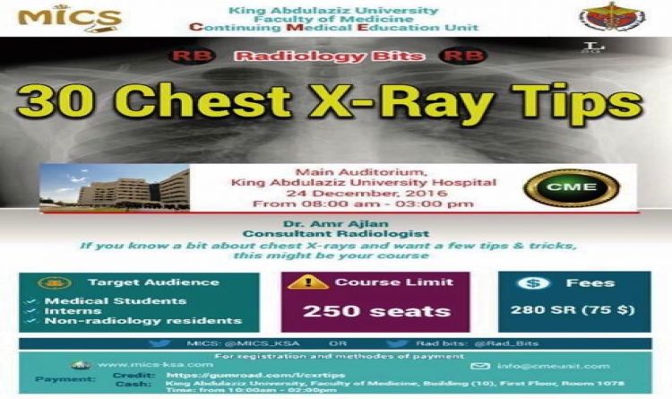 30 Chest XRAY Tips