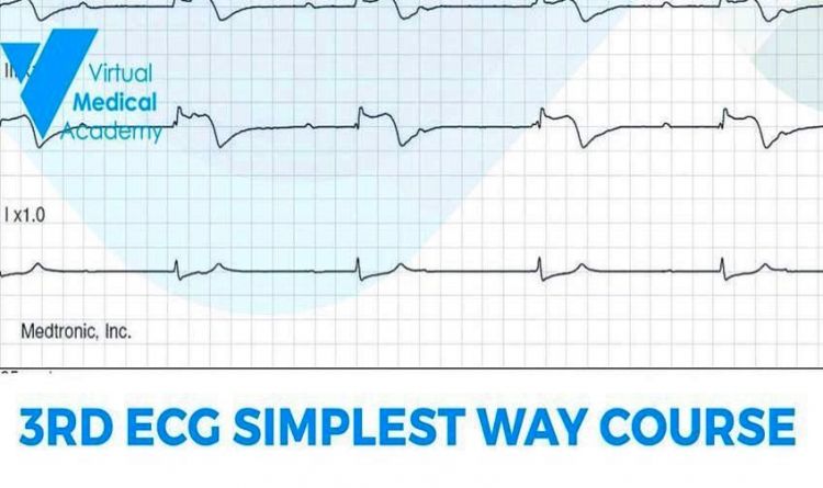 3rd ECG Simplest WAY COURSE