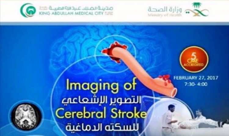 Imaging of Cerebral Stroke