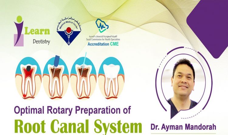 Optimal Rotary Preparation of Root Canal System