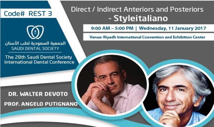 Direct / Indirect Anteriors and Posteriors - SYSLEITALIANO