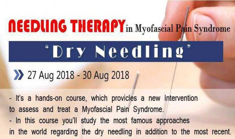 NEEDLING THERAPY in Myofascial  Pain Syndrome